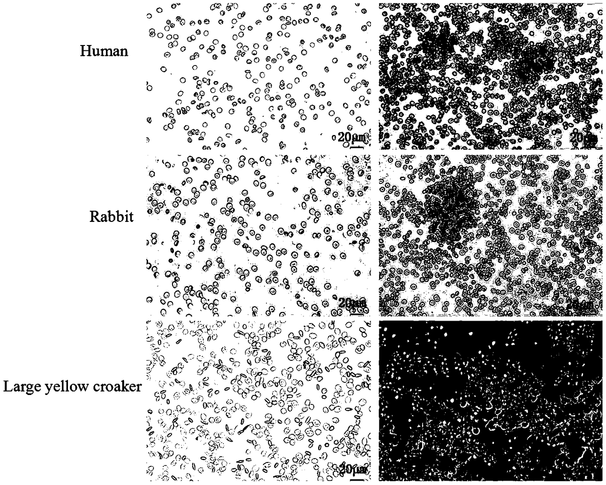 Large yellow croaker c-lectin nattectin gene and its recombinant protein and application