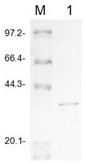 A lamprey immune protein lip mutant that can be used as a tumor diagnostic marker