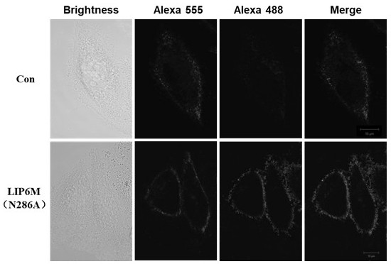 A lamprey immune protein lip mutant that can be used as a tumor diagnostic marker