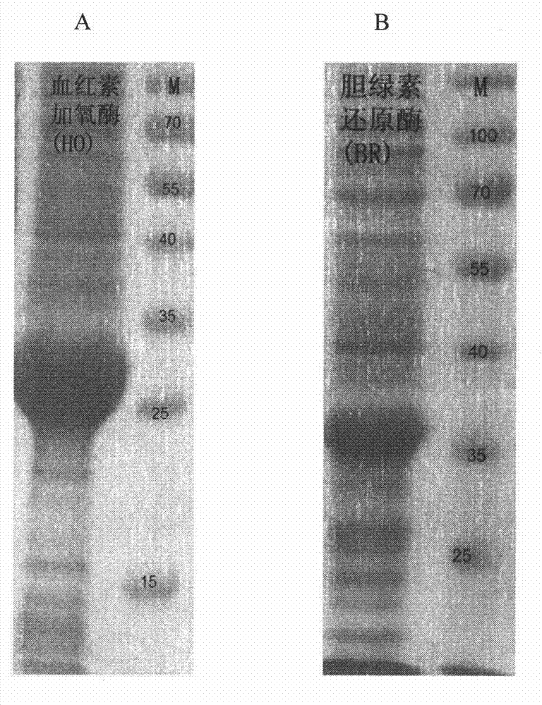 Method for synthesizing bilirubin by utilizing immobilized enzyme