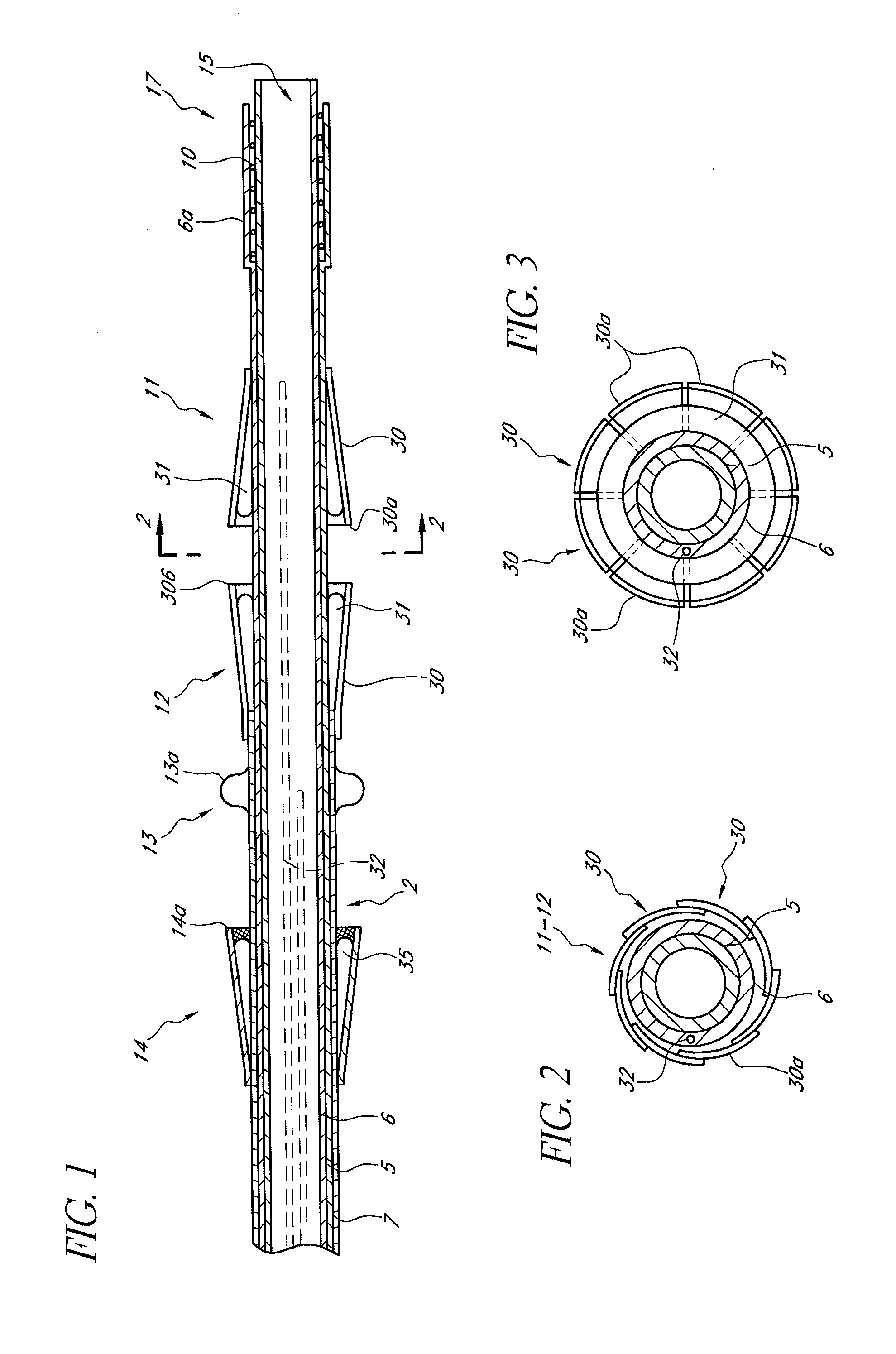 System and method for transapical delivery of an annulus anchored self-expanding valve