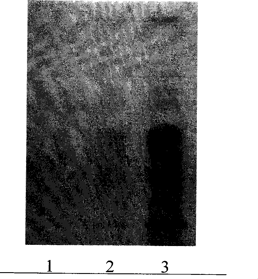 Chinese medicinal composition for treating gastropathy as well as preparation and quality control method thereof
