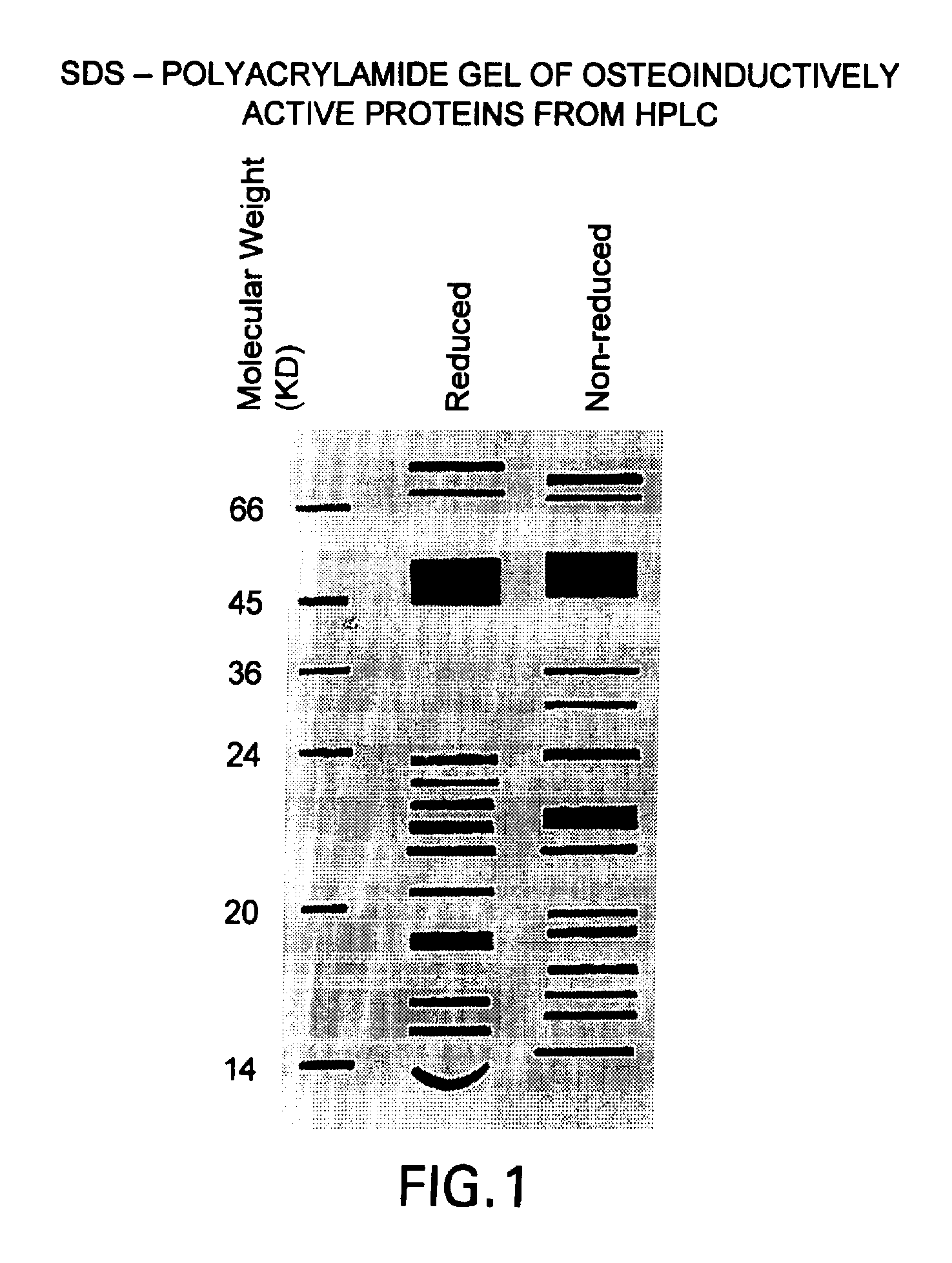 Method of promoting natural bypass
