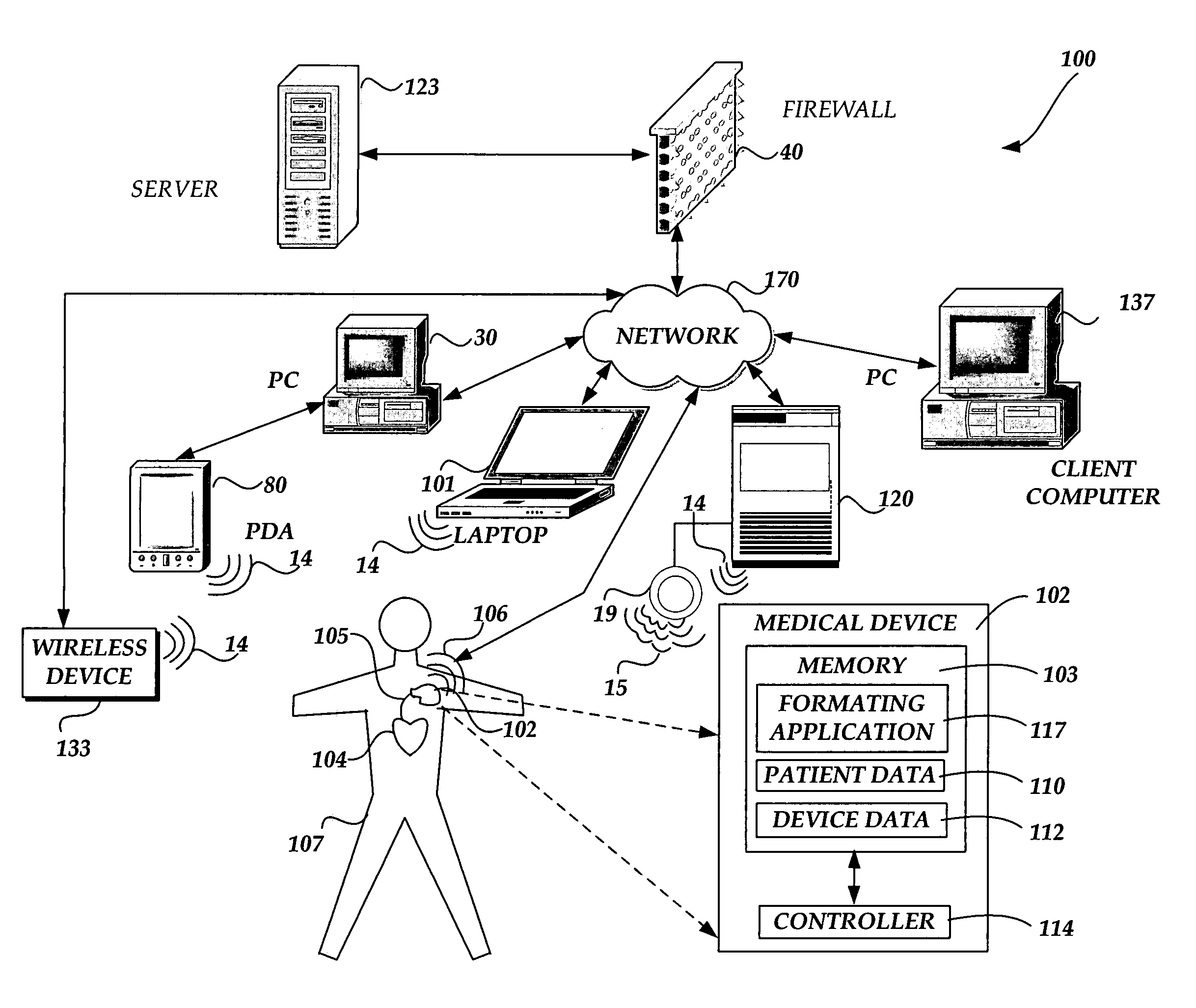 Generating and communicating web content from within an implantable medical device
