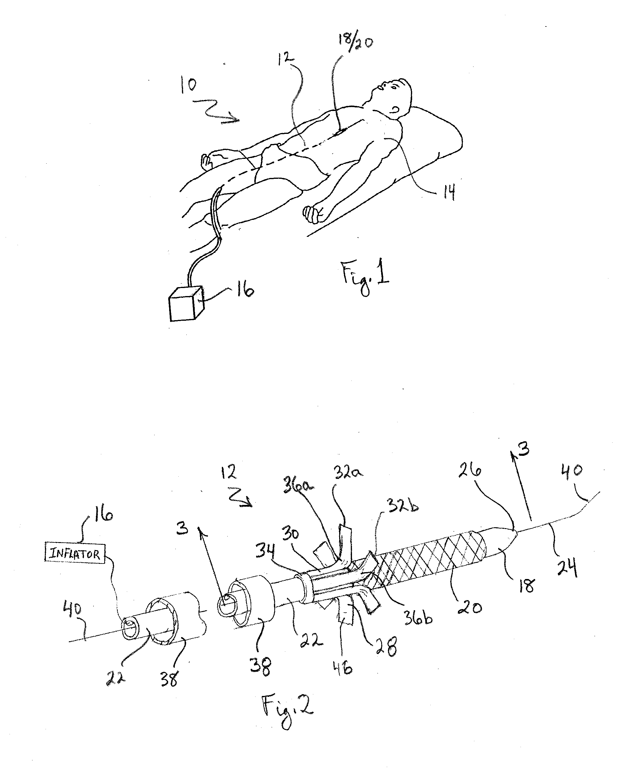 System and Method for Placing a Coronary Stent at the Ostium of a Blood Vessel