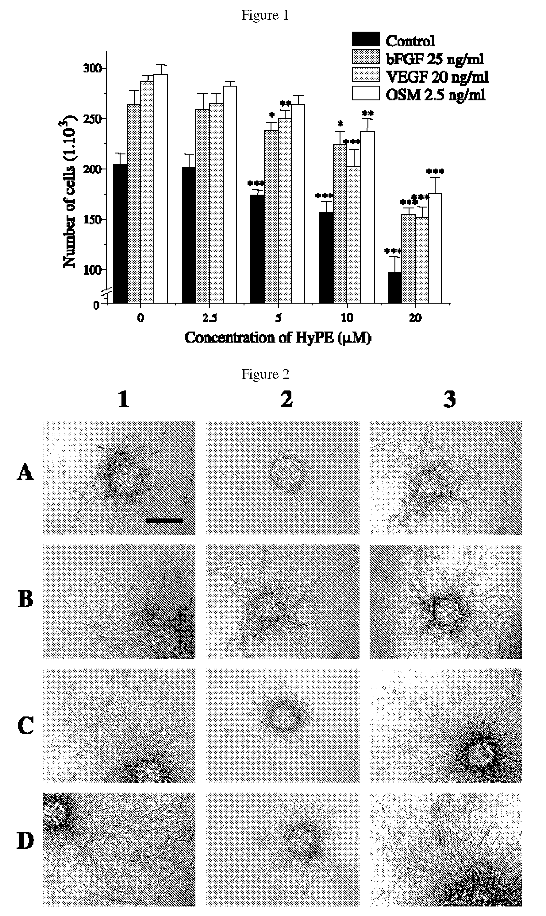 Use of lipid conjugates in the treatment of diseases associated with vasculature