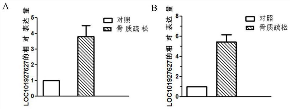 Biomarkers for Osteoporosis Diagnosis and Treatment