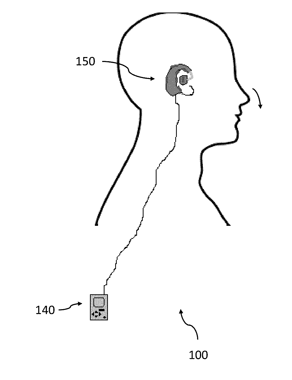 Systems and methods for treating tinnitus and enhancing hearing