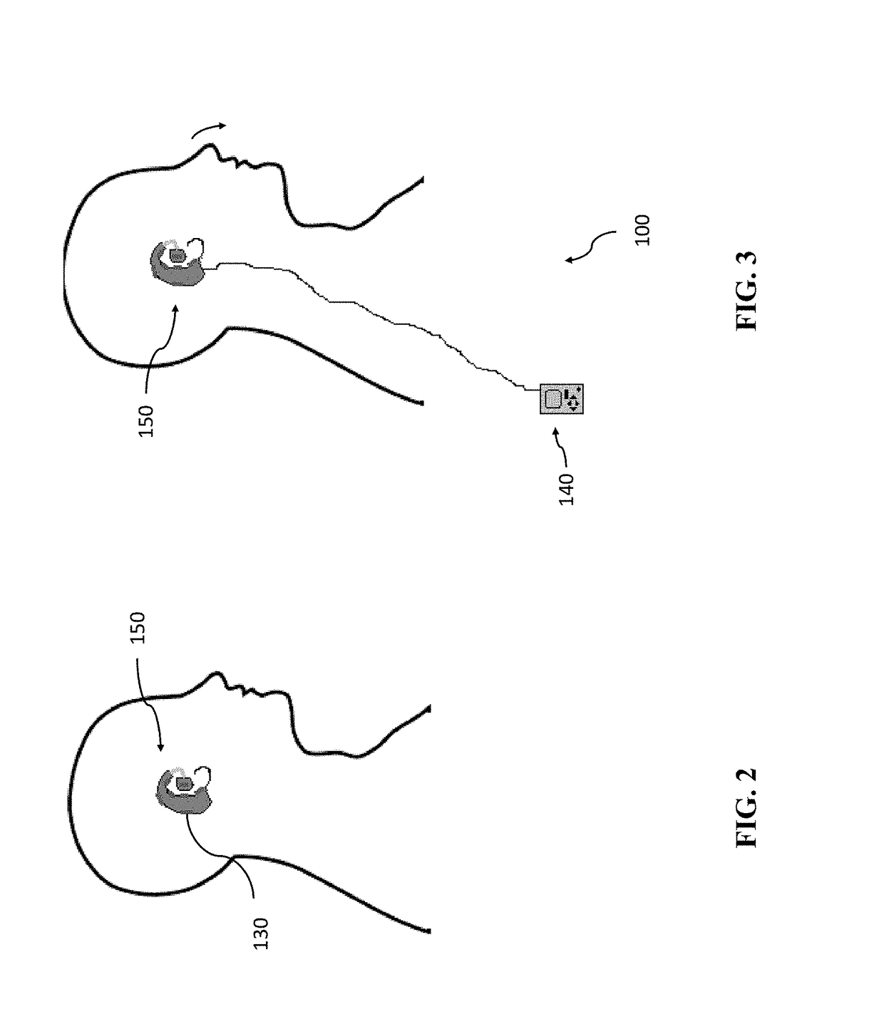 Systems and methods for treating tinnitus and enhancing hearing