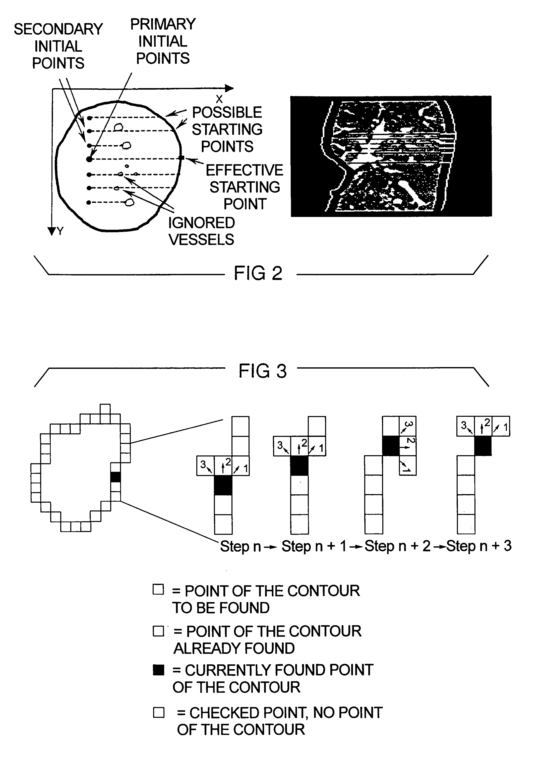 Method and apparatus for processing a computed tomography image of a lung obtained using contrast agent