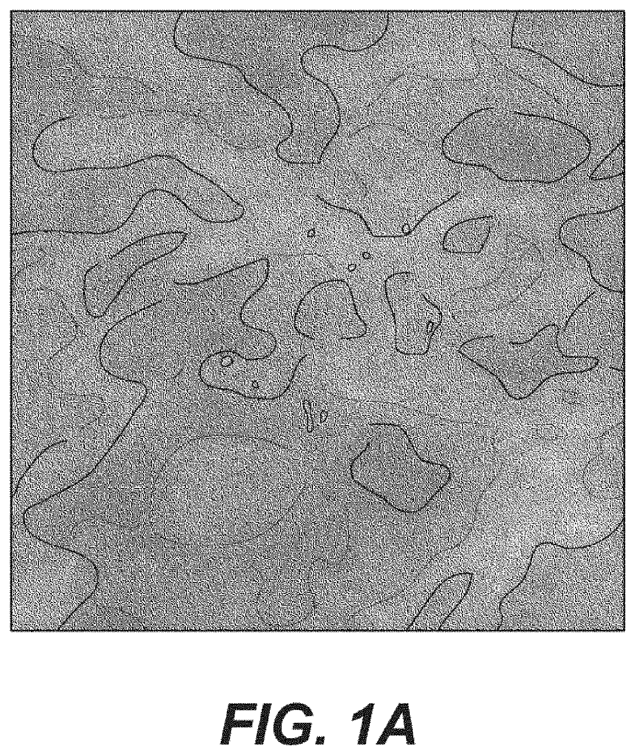 System, method and computer-accessible medium for a patient selection for a ductal carcinoma in situ observation and determinations of actions based on the same