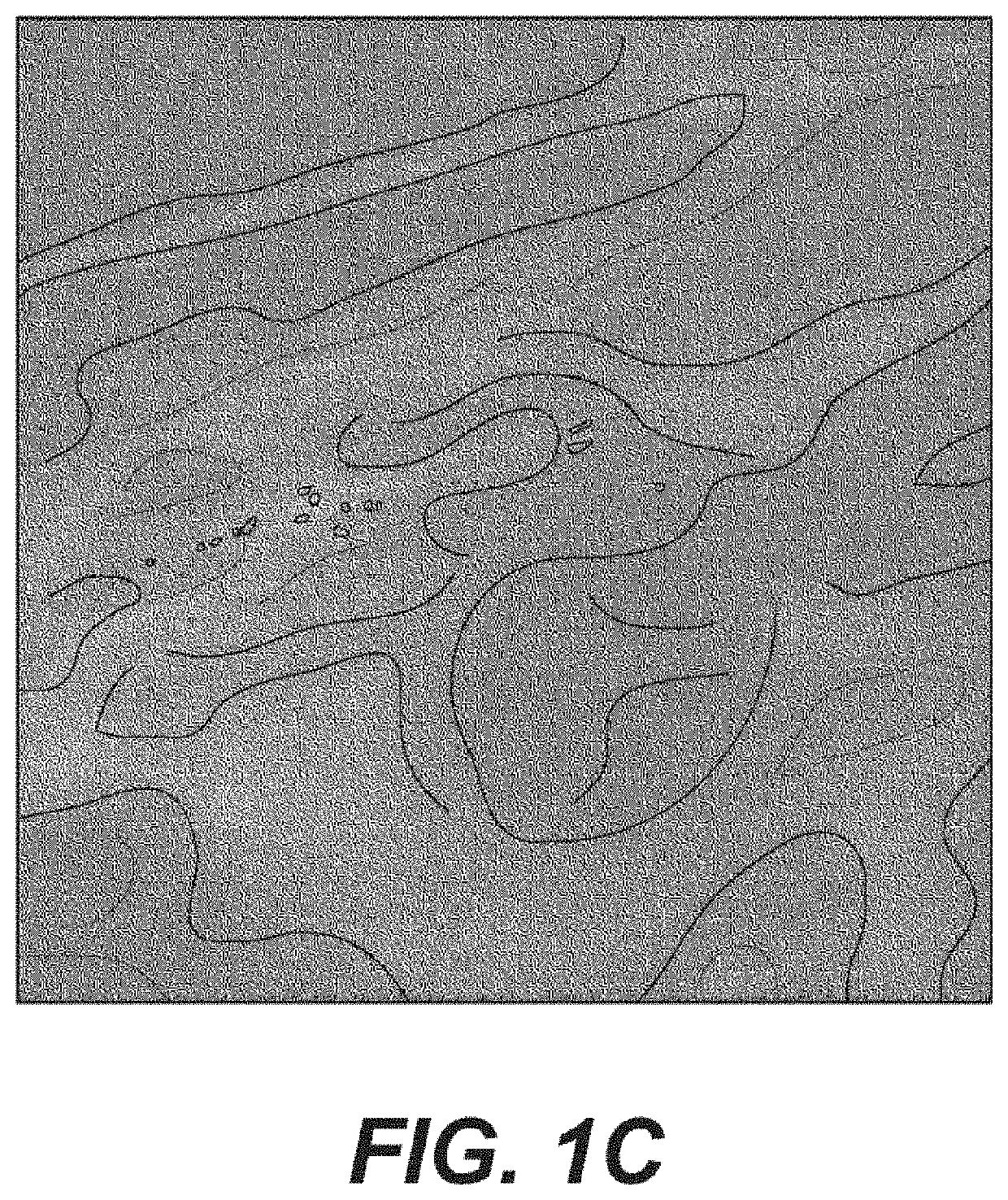 System, method and computer-accessible medium for a patient selection for a ductal carcinoma in situ observation and determinations of actions based on the same