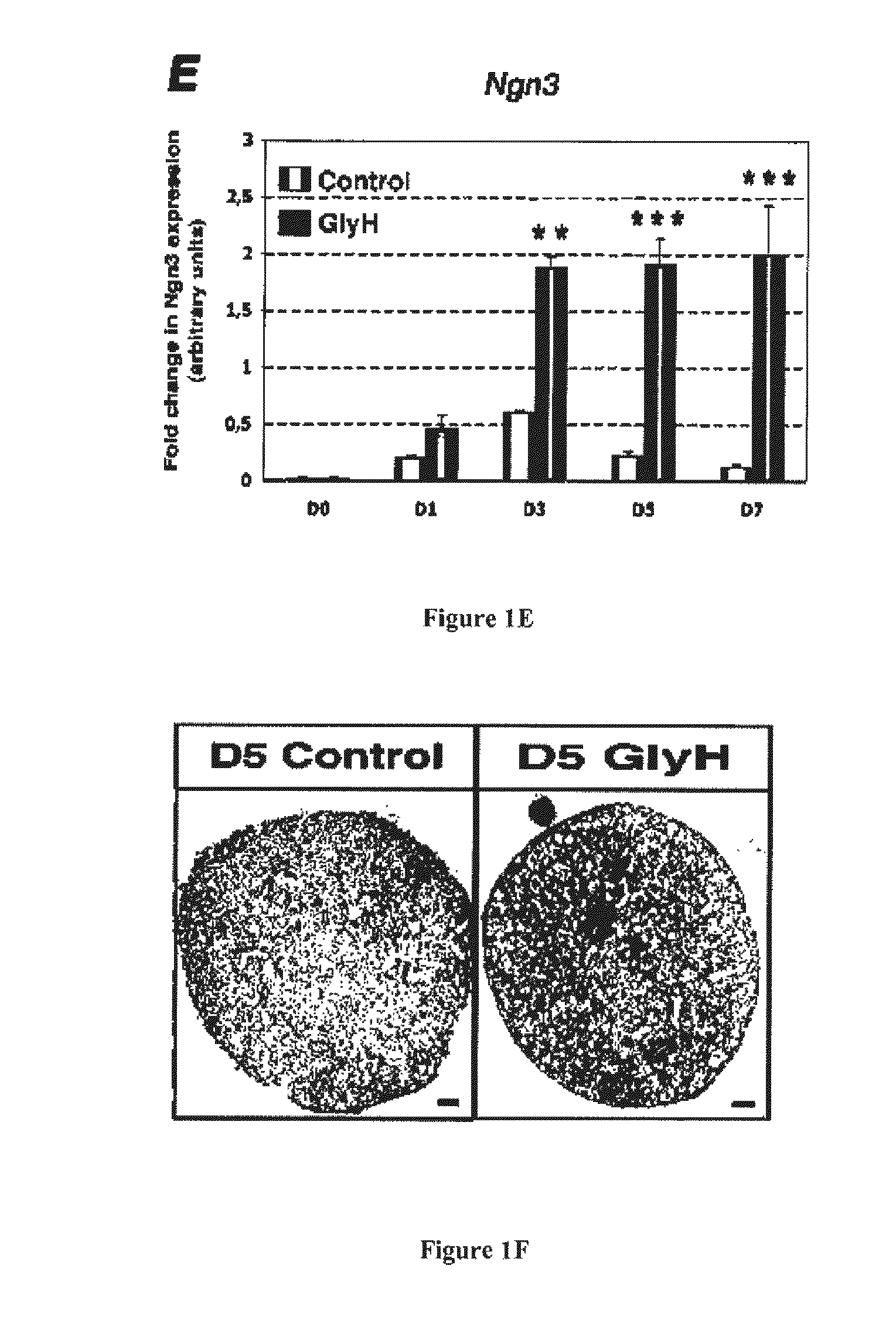 Methods and pharmaceutical compositions for the treatment of disorders of glucose homeostasis
