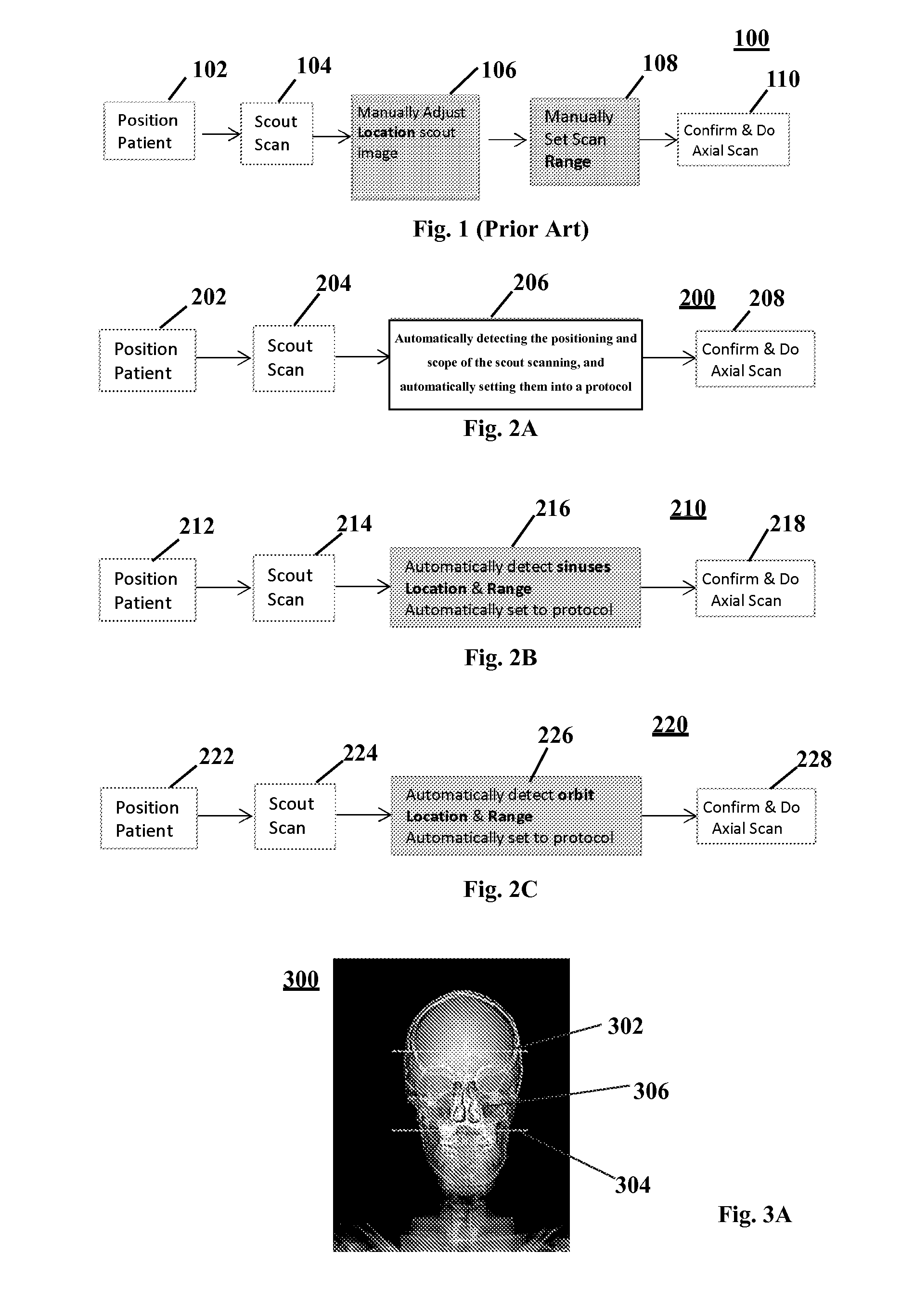 Automatic scanning and positioning apparatus for a scout image