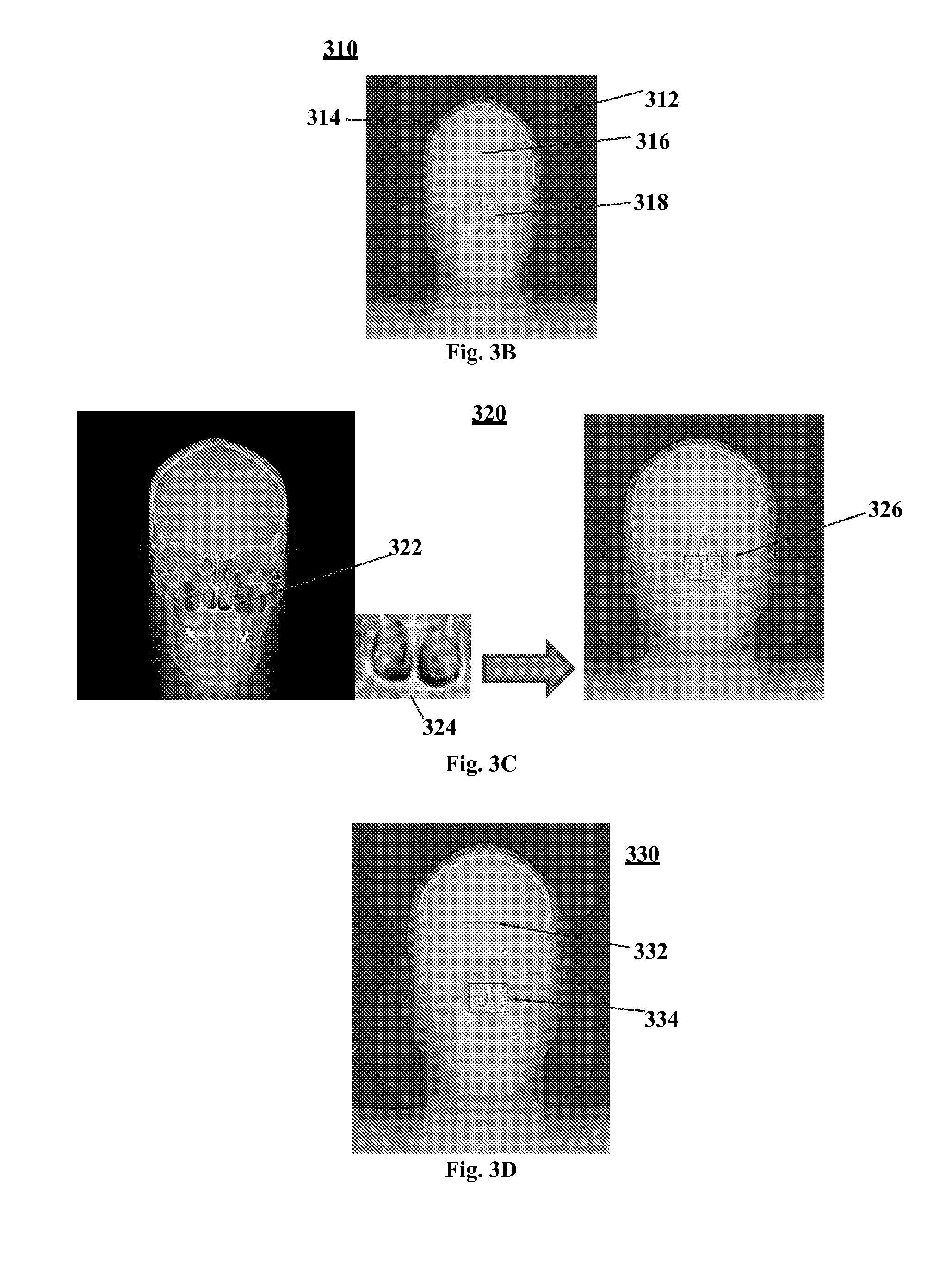 Automatic scanning and positioning apparatus for a scout image