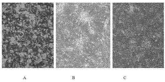 Acquisition method of adipose-derived stem cells