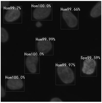 Antinuclear antibody karyotype interpretation method and device based on deep learning