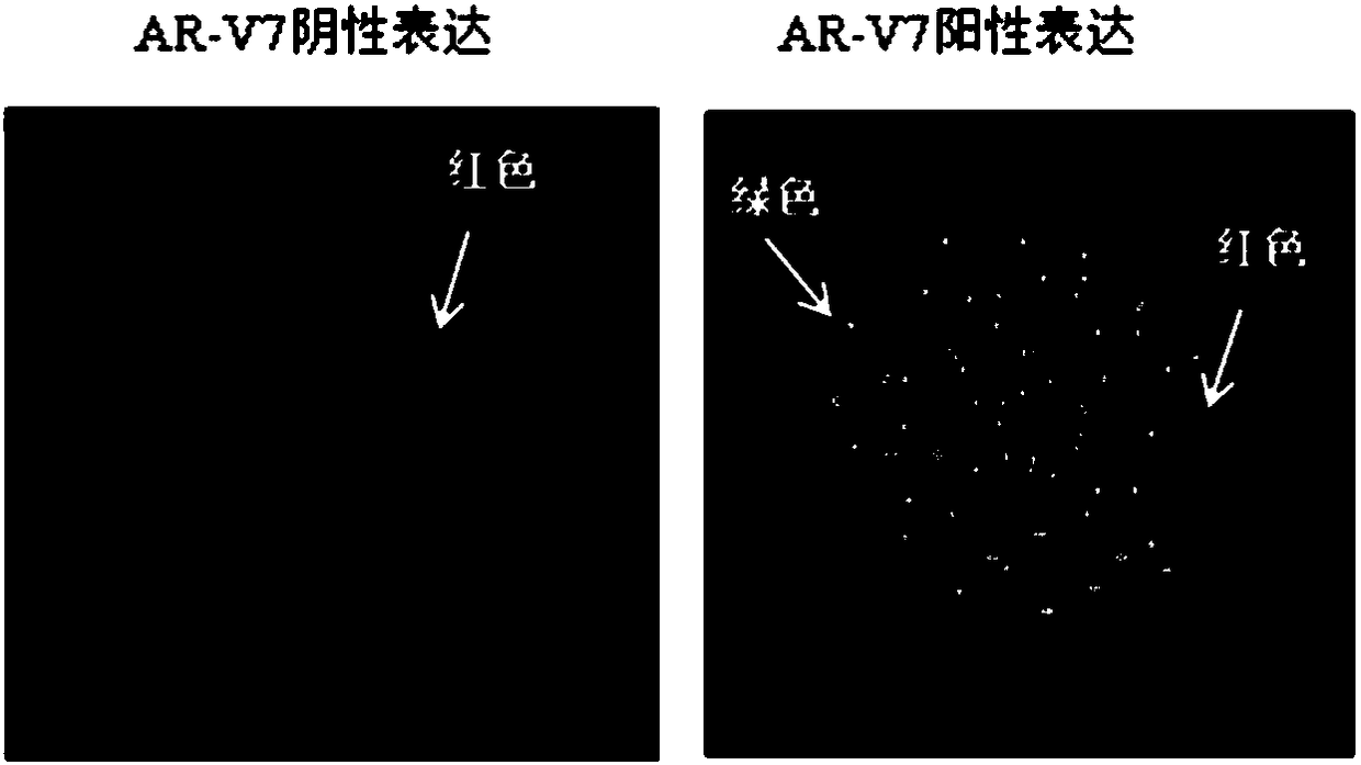A detection kit for the expression of AR-V7