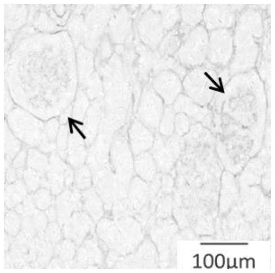 Construction method of three-dimensional tumor model acellular derived matrix stent and application thereof