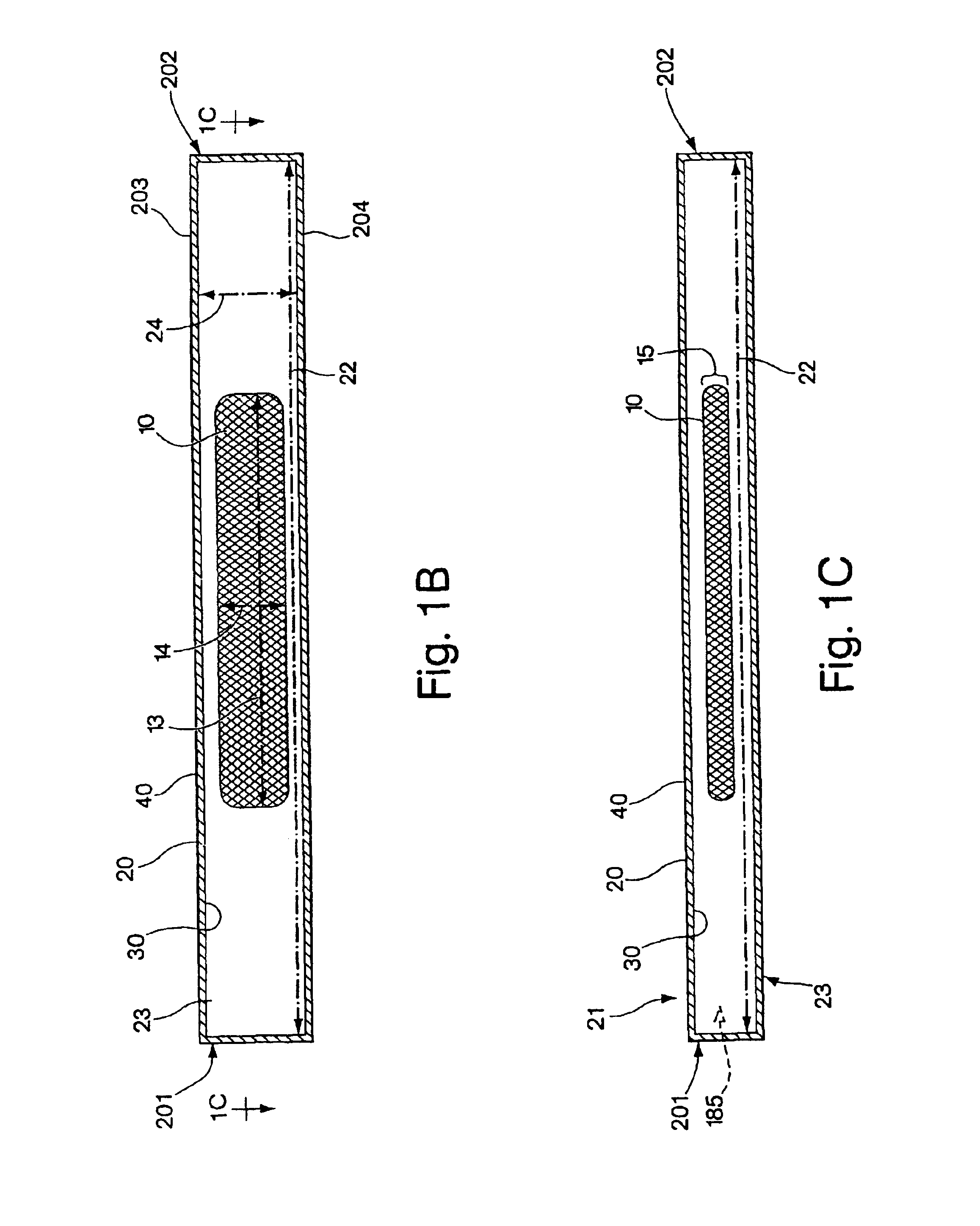 System for implanting an implant and method thereof