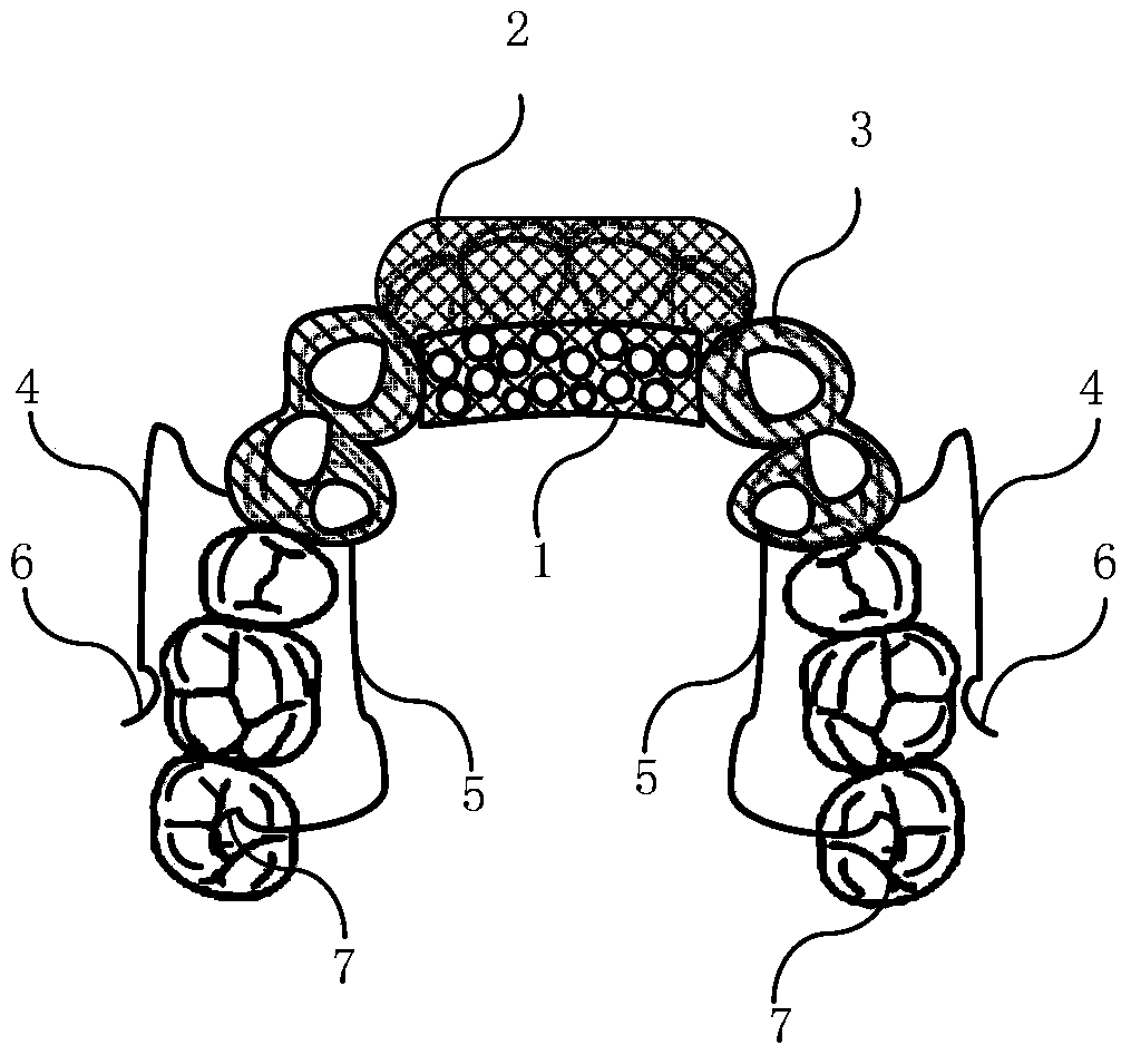 Orthodontic device