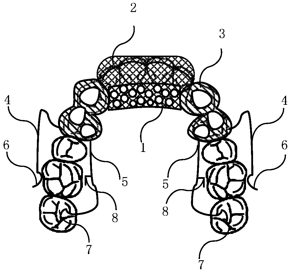 Orthodontic device