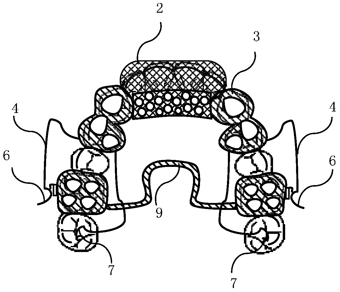 Orthodontic device