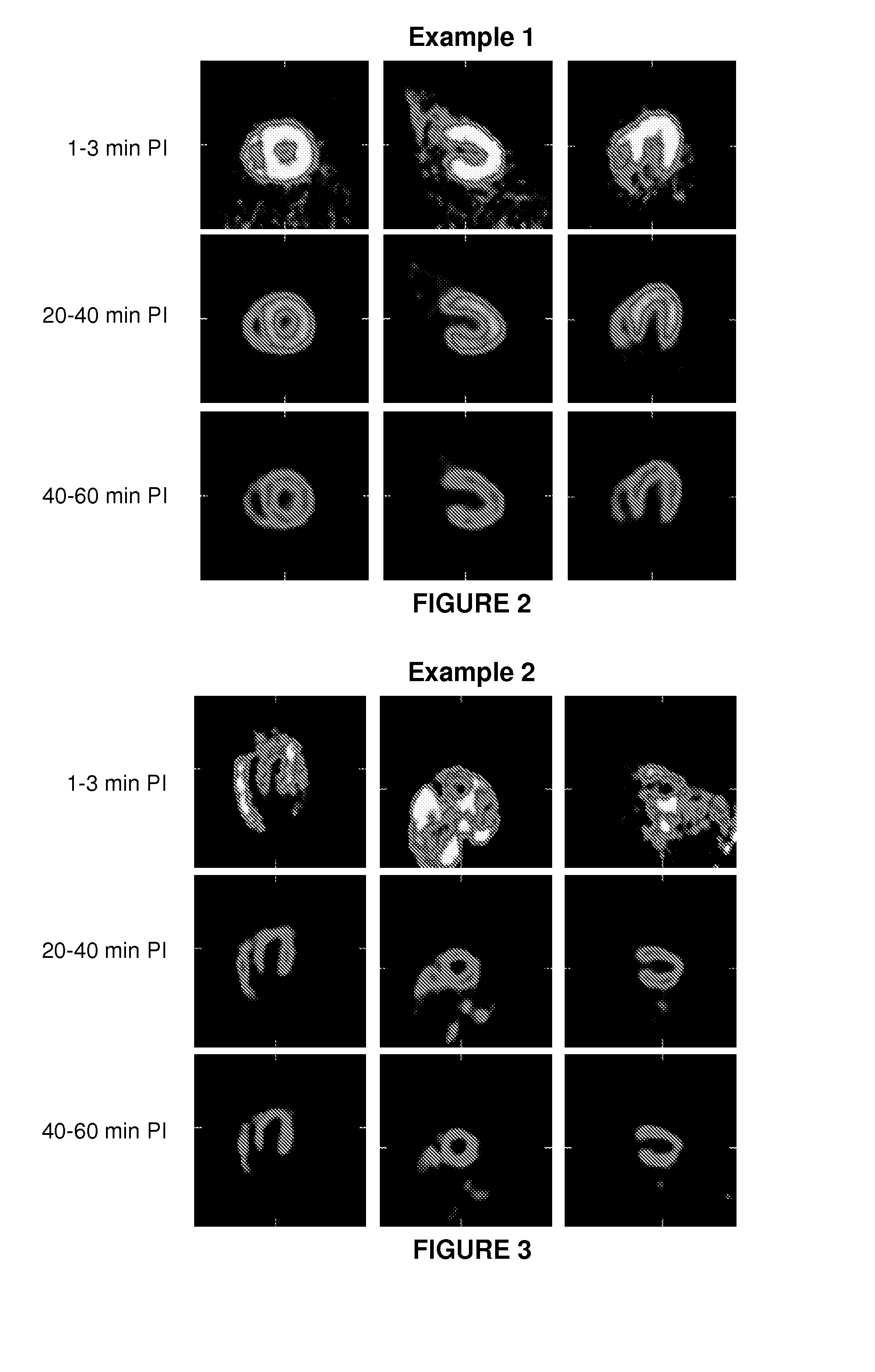 Compositions, methods, and systems for the synthesis and use of imaging agents