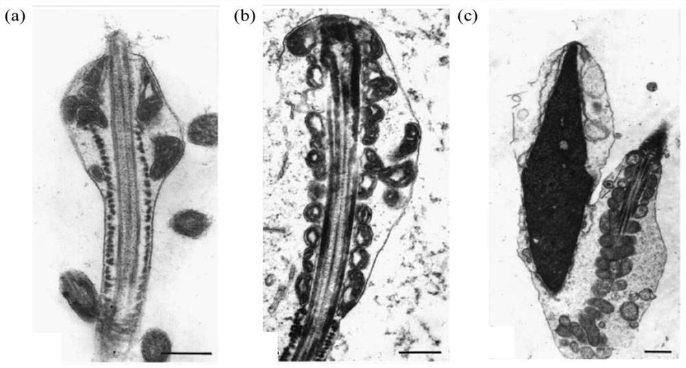 Application of ACTRT1 as target in detection and treatment of acephalic spermatozoa (AS)