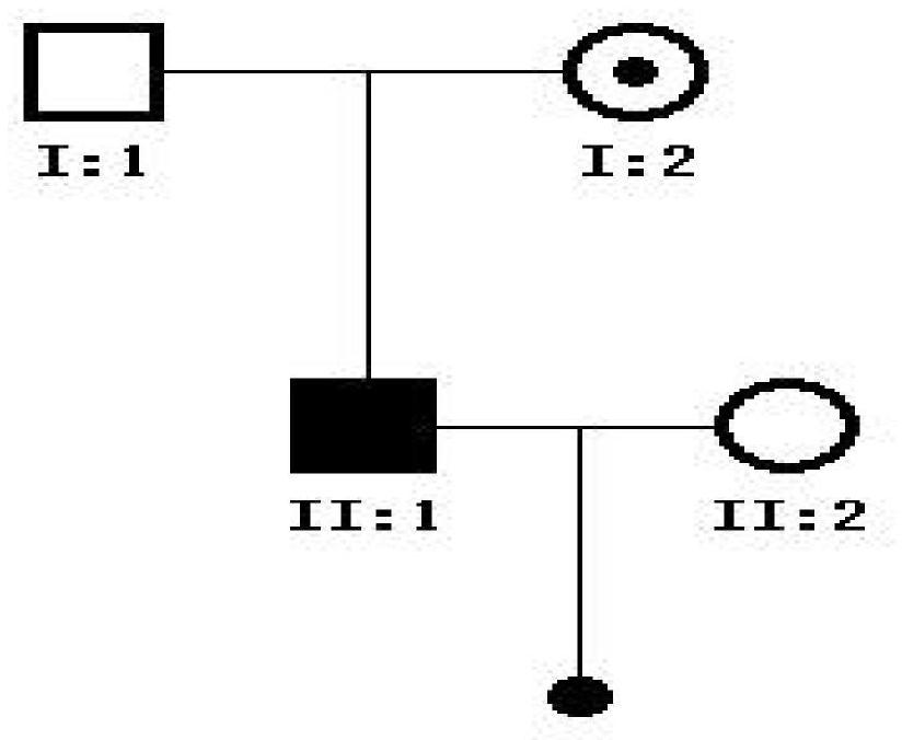 Application of ACTRT1 as target in detection and treatment of acephalic spermatozoa (AS)