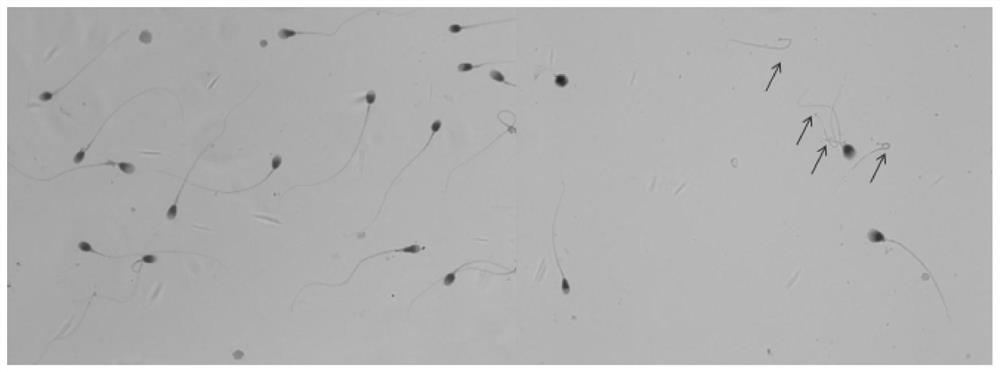 Application of ACTRT1 as target in detection and treatment of acephalic spermatozoa (AS)