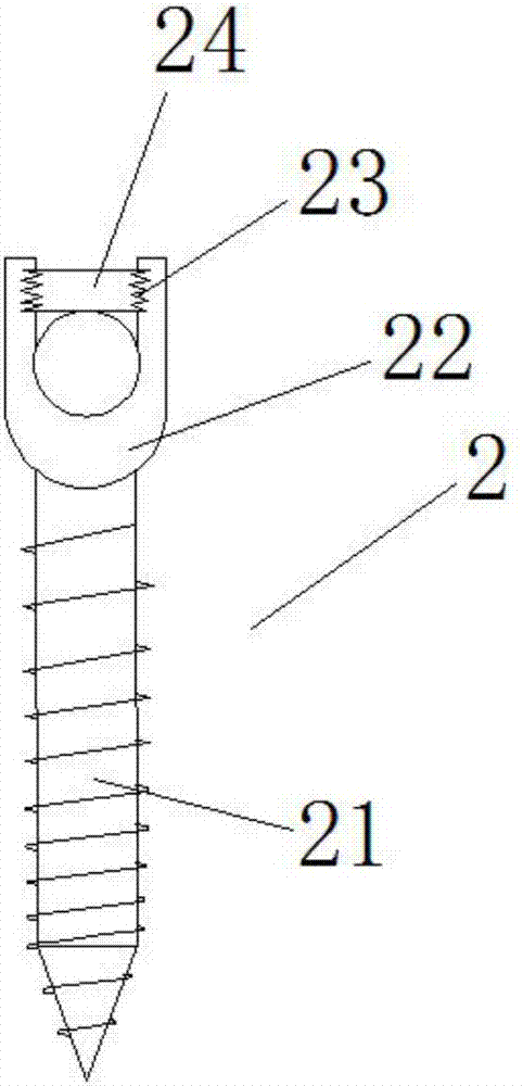 Non-fusion lumbar vertebra fixing device