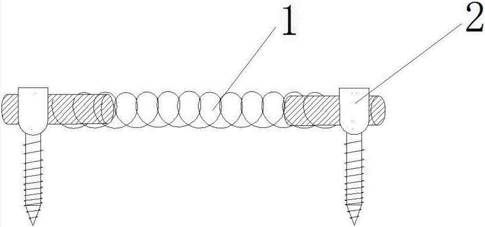 Non-fusion lumbar vertebra fixing device