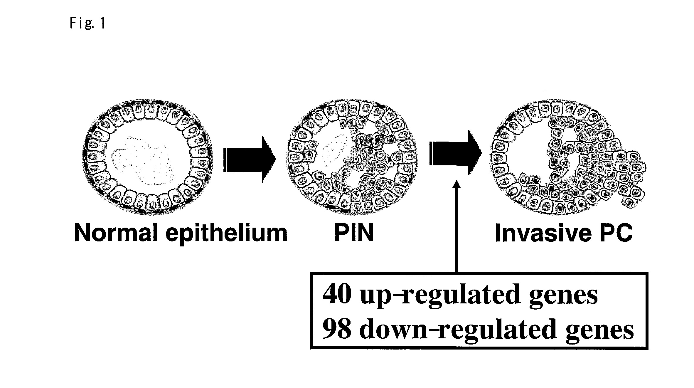 Pin-Prc Transition Genes