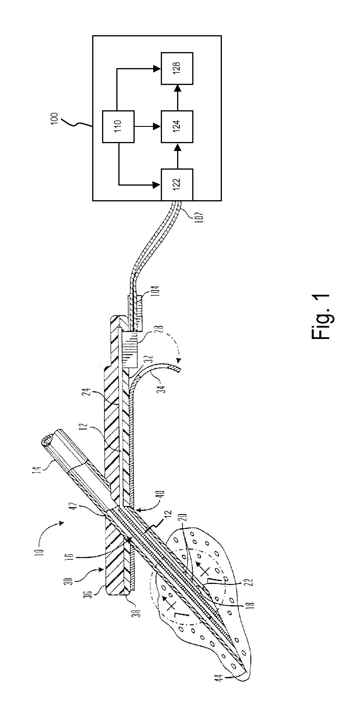 Method and System for Remedying Sensor Malfunctions Detected by Electrochemical Impedance Spectroscopy