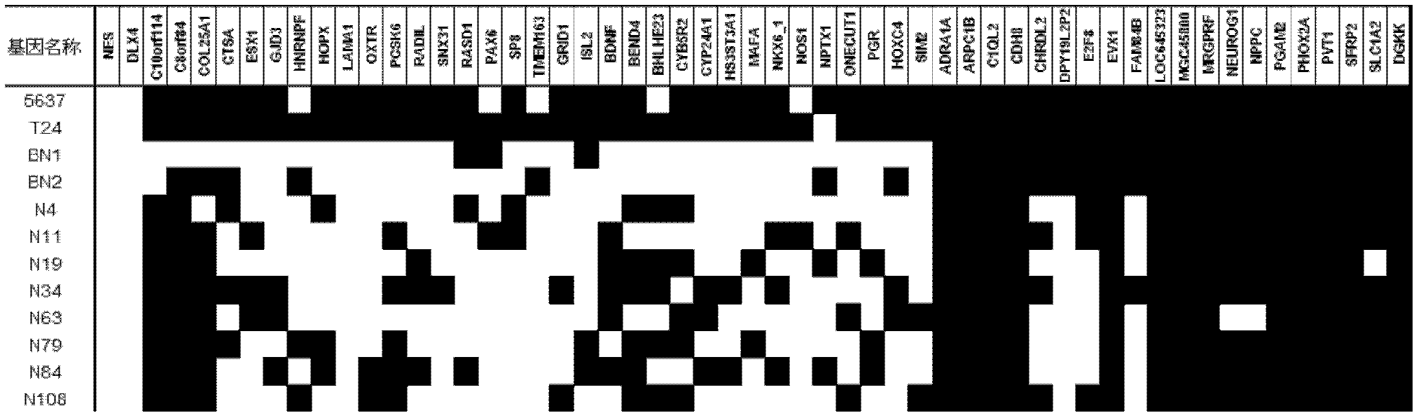 Method and kit for diagnosing bladder cancer with urine