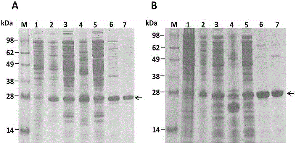 Recombined ULP1 kinase coding sequence, coding protein, plasmid containing recombined ULP1 kinase coding sequence and recombined ULP1 kinase preparation method