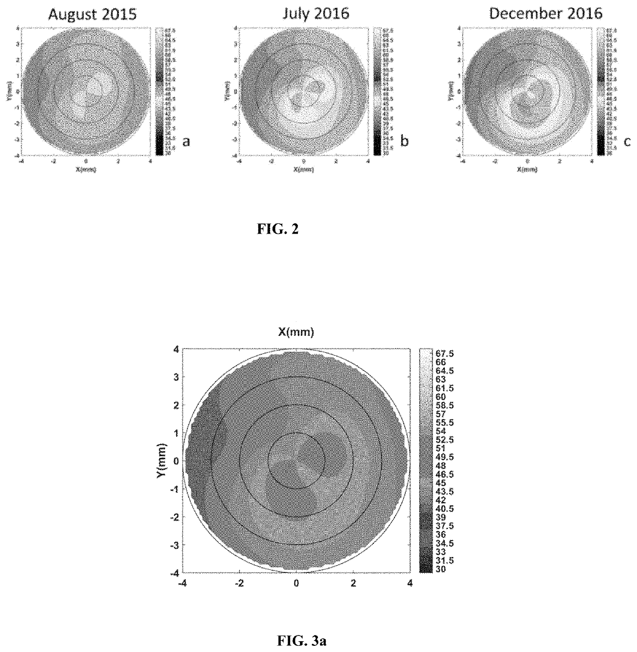 A system and method of artificial intelligence and tomography imaging of human cornea