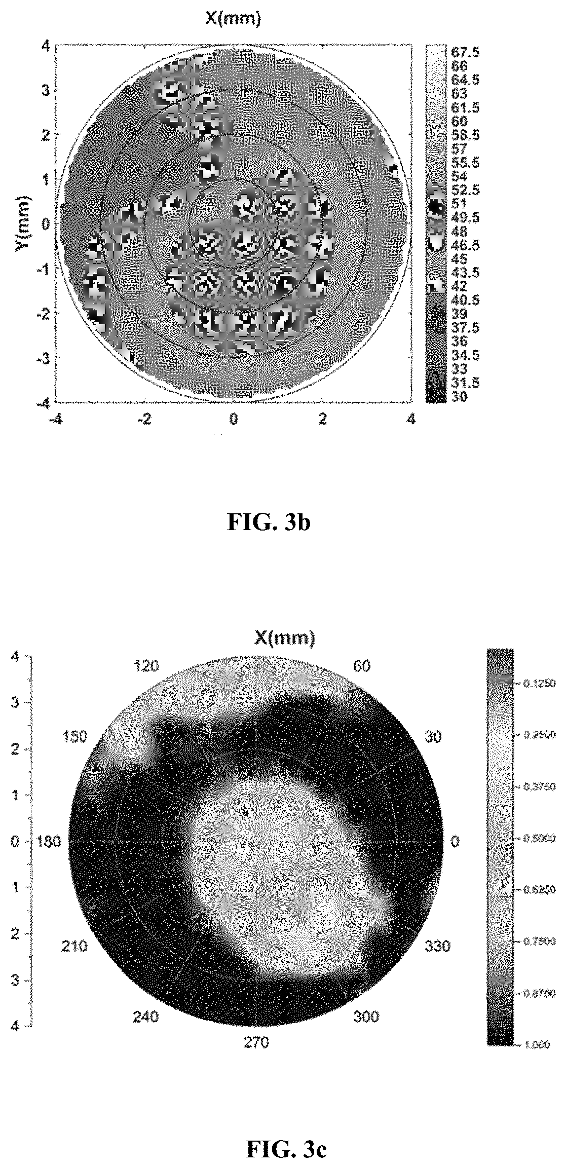 A system and method of artificial intelligence and tomography imaging of human cornea