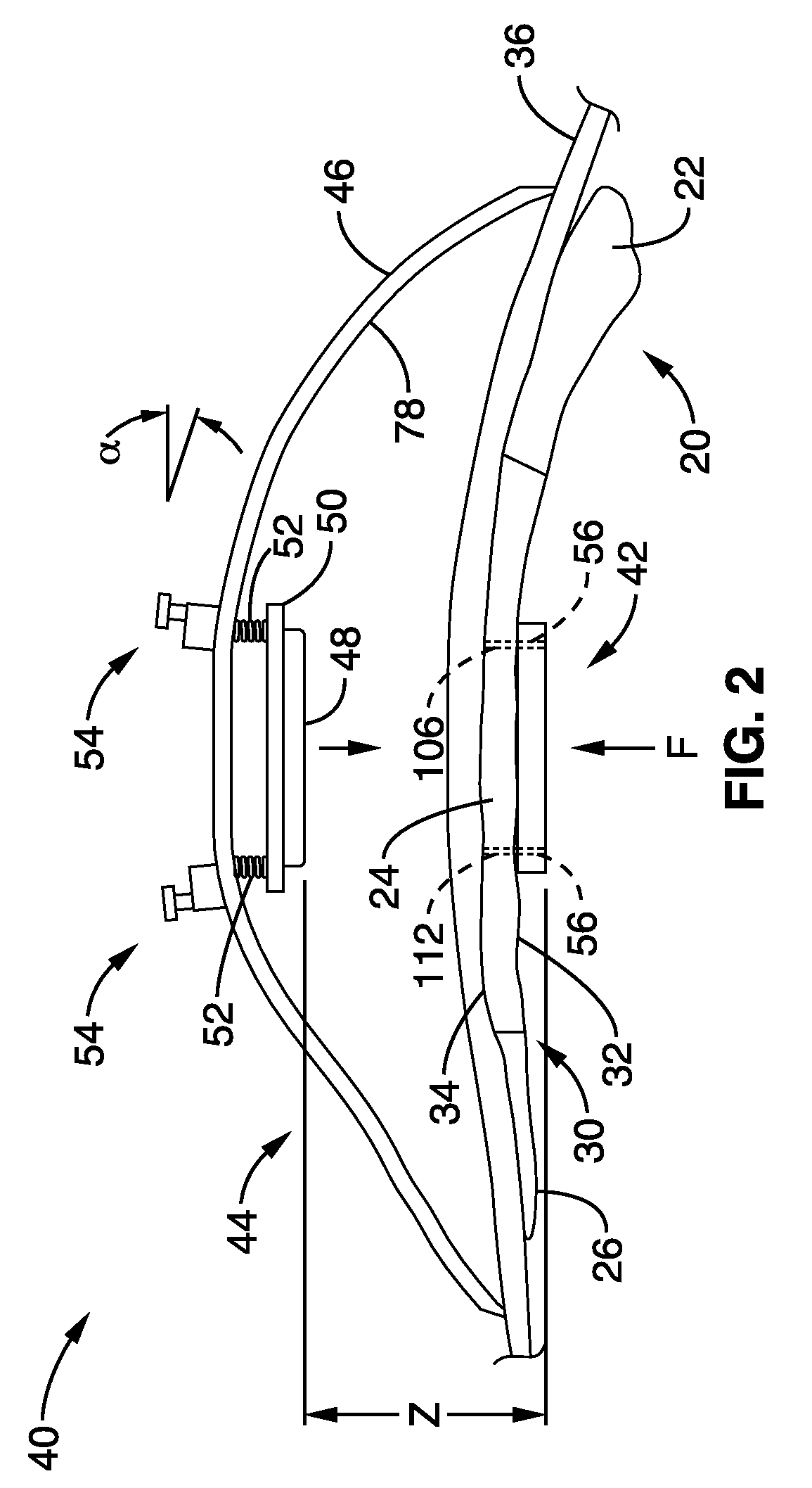 Apparatus and method for magnetic alteration of anatomical features