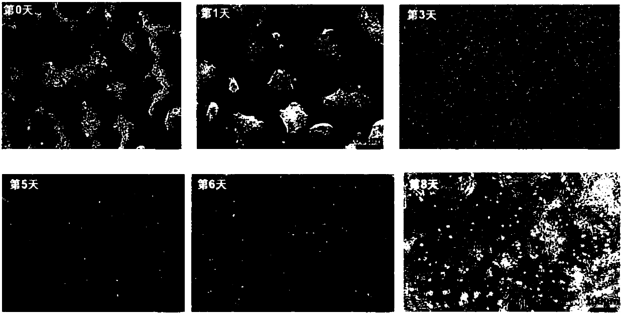 Method for preparing vascular endothelial cells and kit specially used for method