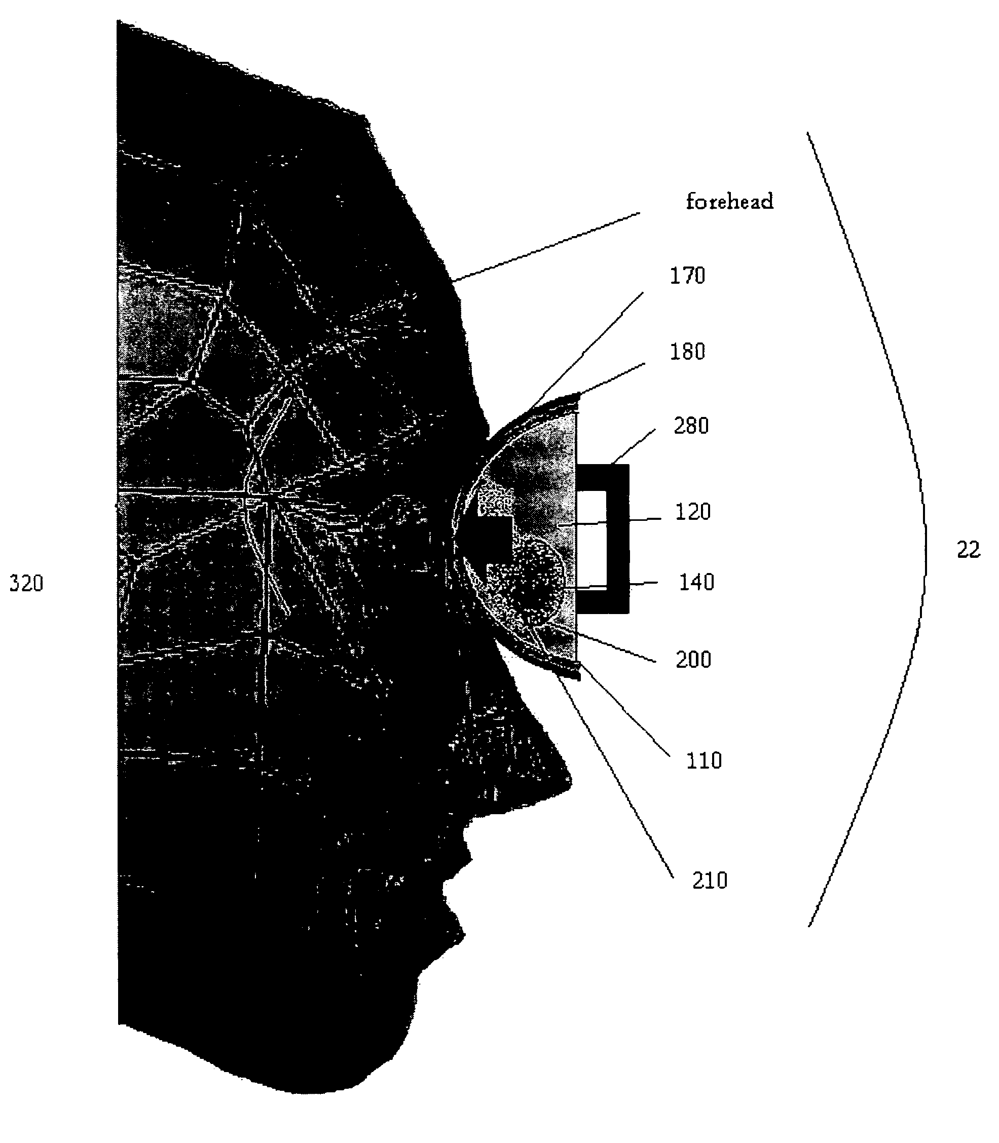 Device and method for treatment of eyelid diseases