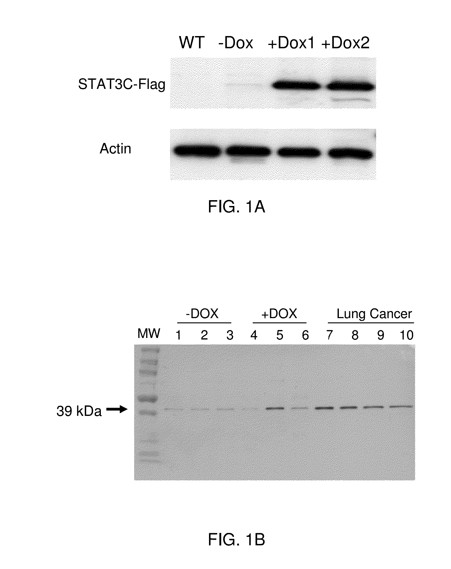 Compositions and Methods for Diagnosing Lung Cancer