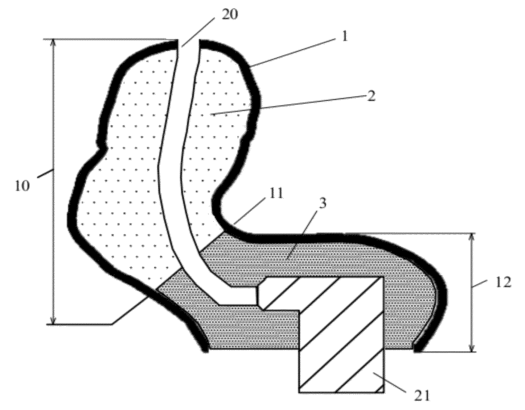 Concha-Fitting Custom Earplug with Flexible Skin and Filler Material