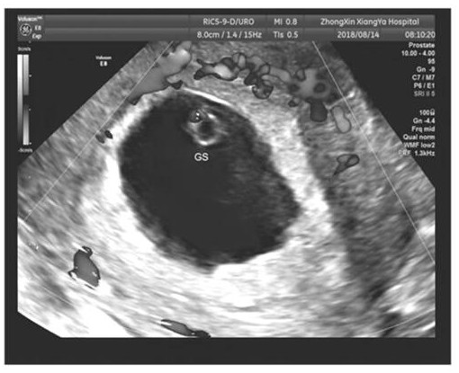 A method for calculating fetal heart rate in the first trimester of pregnancy based on upper-color blood flow diagram in b-ultrasound detection