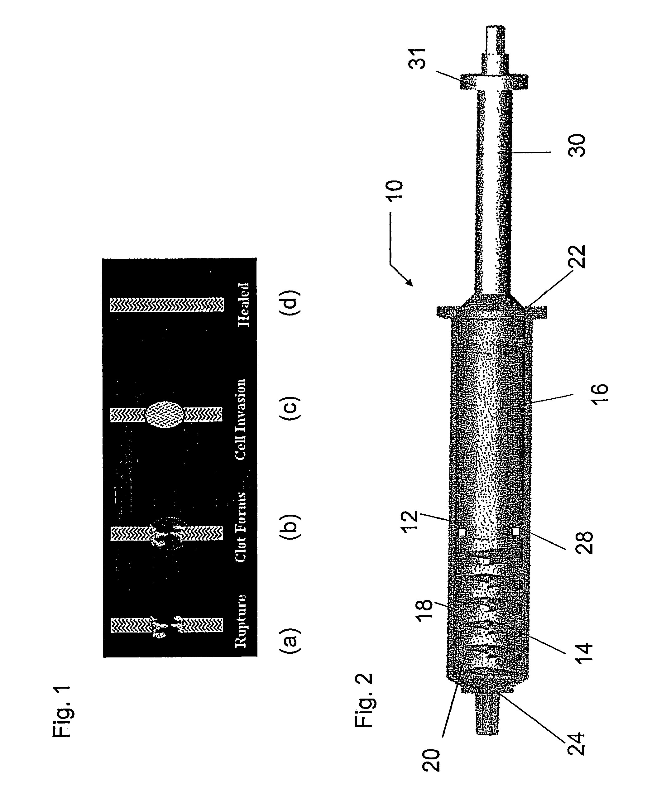 Device for mixing and delivering fluids for tissue repair