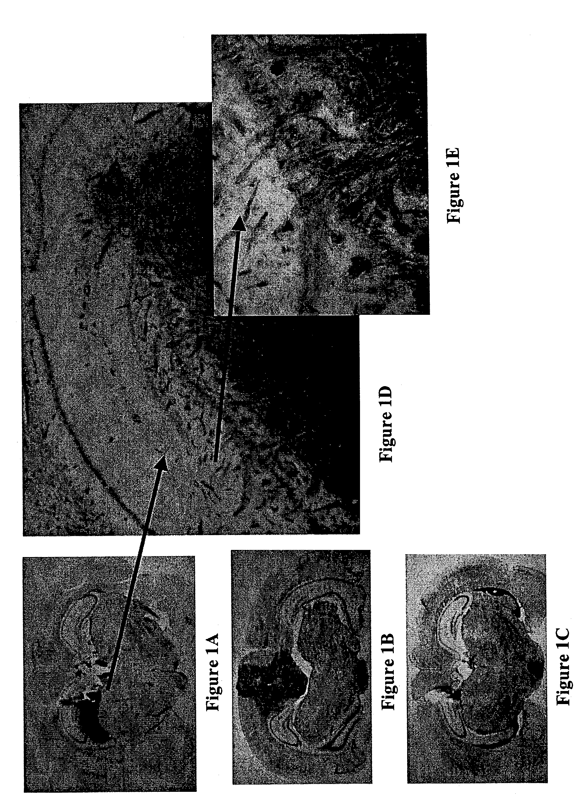 Substituted tetrahydroisoquinoline compounds, methods of making, and their use