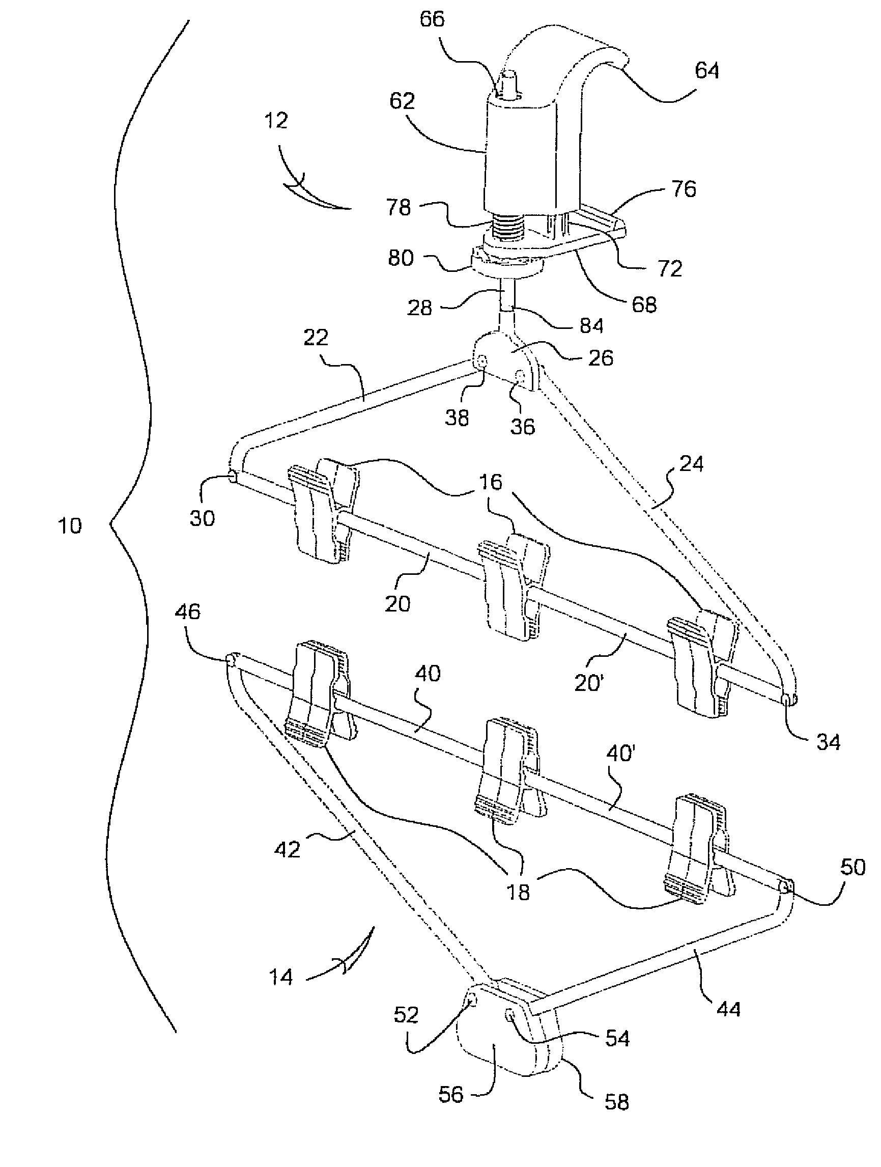 Combination bracket and garment hanger system and assembly mountable to an overhead trim piece associated with a doorway such as for rotatably supporting a garment during steam cleaning