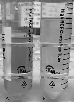 High-density fermentation method of recombinant EK enzyme engineering bacteria