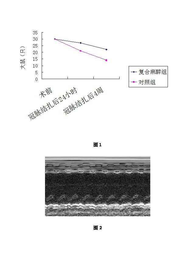 Composite anesthetic, preparation method thereof, and use thereof in myocardial infarction animal model